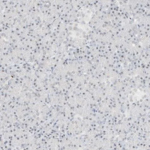 Immunohistochemistry (Formalin/PFA-fixed paraffin-embedded sections) - Anti-SPT5 antibody (AB244429)