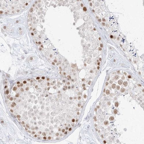 Immunohistochemistry (Formalin/PFA-fixed paraffin-embedded sections) - Anti-SPT5 antibody (AB244429), expandable thumbnail