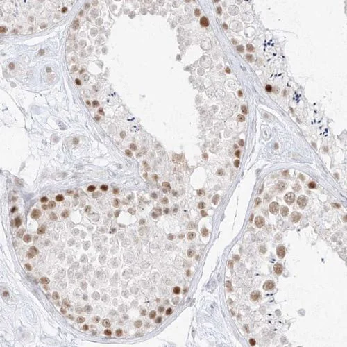 Immunohistochemistry (Formalin/PFA-fixed paraffin-embedded sections) - Anti-SPT5 antibody (AB244429)