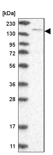 Western blot - Anti-SPT5 antibody (AB244429), expandable thumbnail