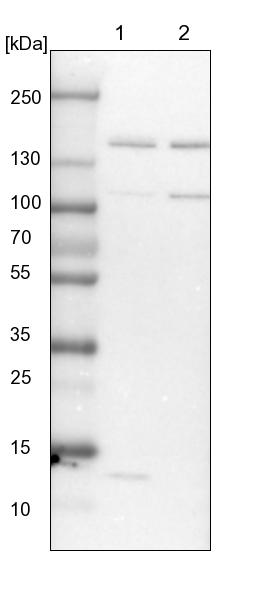 Western blot - Anti-SPT5 antibody (AB244429), expandable thumbnail