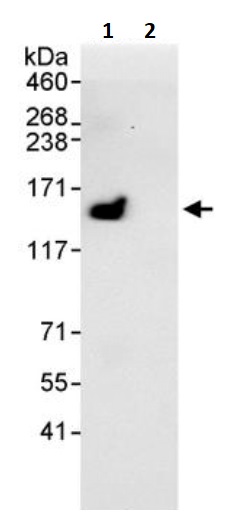 Immunoprecipitation - Anti-SPT5 antibody (AB245650)