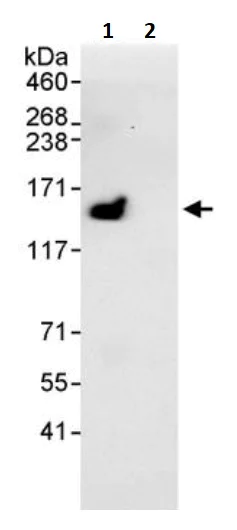 Immunoprecipitation - Anti-SPT5 antibody (AB245650)