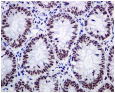 Immunohistochemistry (Formalin/PFA-fixed paraffin-embedded sections) - Anti-SPT5 antibody [EPR5145(2)] (AB126592)