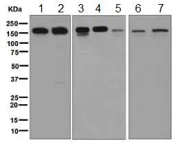 Western blot - Anti-SPT5 antibody [EPR5145(2)] (AB126592)