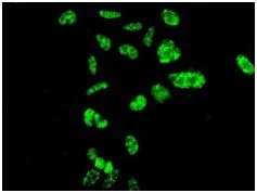 Immunocytochemistry/ Immunofluorescence - Anti-SPT5 antibody [EPR5145(2)] - BSA and Azide free (AB248118)