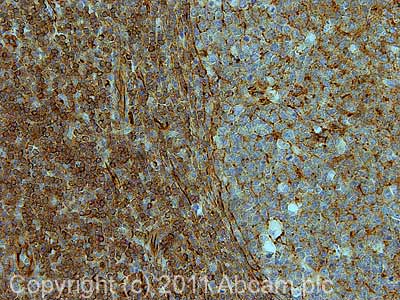 Immunohistochemistry (Formalin/PFA-fixed paraffin-embedded sections) - Anti-SPTBN1 antibody (AB72239), expandable thumbnail