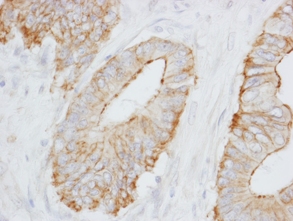 Immunohistochemistry (Formalin/PFA-fixed paraffin-embedded sections) - Anti-SPTBN1 antibody (AB72239), expandable thumbnail