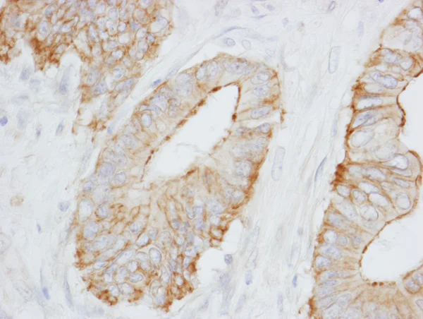 Immunohistochemistry (Formalin/PFA-fixed paraffin-embedded sections) - Anti-SPTBN1 antibody (AB72239)