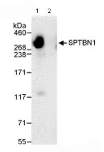 Immunoprecipitation - Anti-SPTBN1 antibody (AB72239), expandable thumbnail