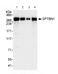 Western blot - Anti-SPTBN1 antibody (AB72239)