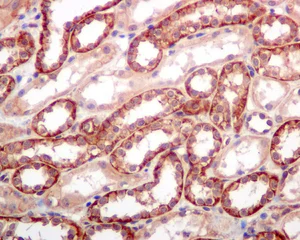 Immunohistochemistry (Formalin/PFA-fixed paraffin-embedded sections) - Anti-SPTBN1 antibody [EPR5869] (AB124888)