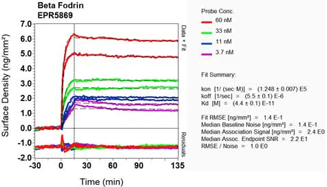 OI-RD Scanning - Anti-SPTBN1 antibody [EPR5869] (AB124888)