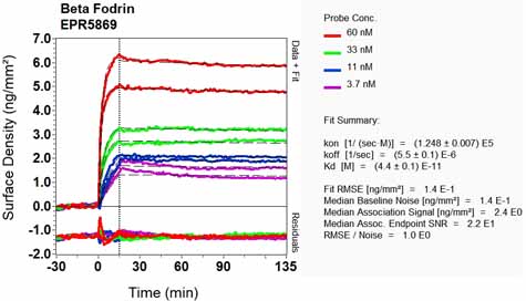 OI-RD Scanning - Anti-SPTBN1 antibody [EPR5869] - BSA and Azide free (AB248042), expandable thumbnail