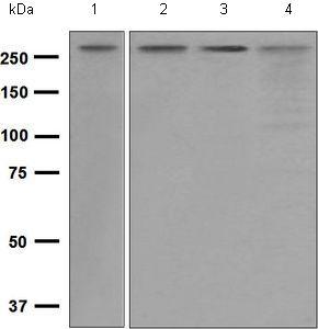 Western blot - Anti-SPTBN1 antibody [EPR5869] - BSA and Azide free (AB248042), expandable thumbnail