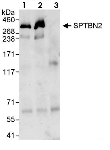 Immunoprecipitation - Anti-SPTBN2 antibody (AB264177)