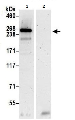 Immunoprecipitation - Anti-SPTBN2 antibody (AB264178), expandable thumbnail