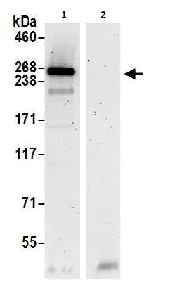 Immunoprecipitation - Anti-SPTBN2 antibody (AB264178)