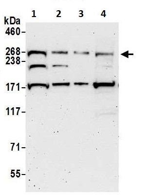 Western blot - Anti-SPTBN2 antibody (AB264178), expandable thumbnail