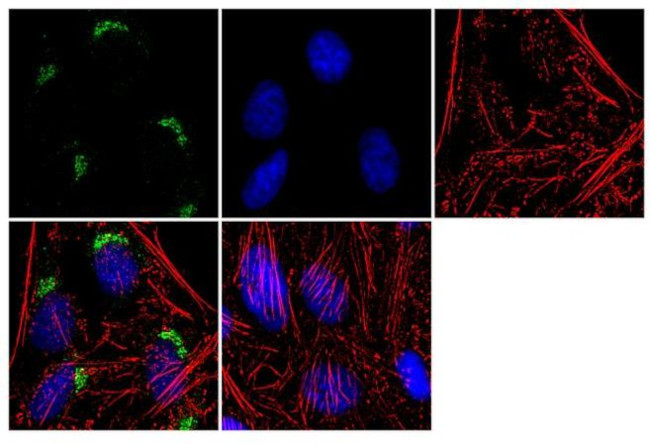 Immunocytochemistry/ Immunofluorescence - Anti-SPTBN2 Antibody [RP23040132] (AB313451), expandable thumbnail