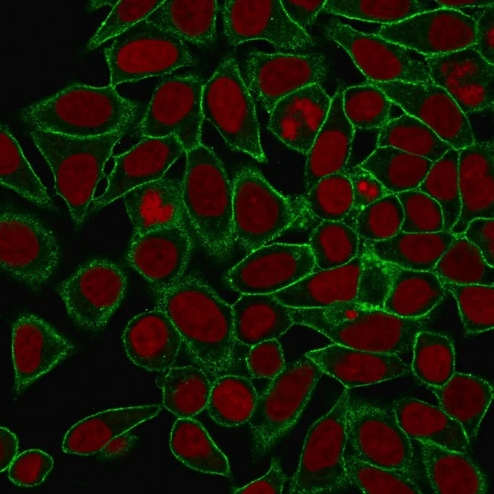 Immunocytochemistry - Anti-SPTBN2 antibody [SPTBN2/1778] (AB238055)