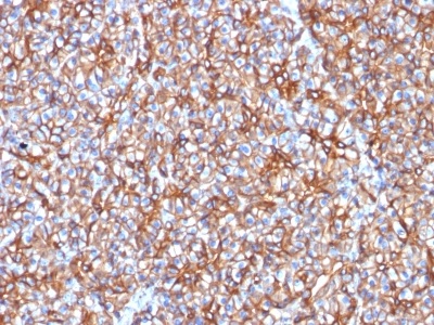 Immunohistochemistry (Formalin/PFA-fixed paraffin-embedded sections) - Anti-SPTBN2 antibody [SPTBN2/1778] (AB238055)