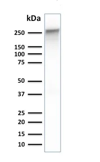 Western blot - Anti-SPTBN2 antibody [SPTBN2/1778] (AB238055)