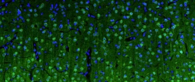 Immunohistochemistry (Formalin/PFA-fixed paraffin-embedded sections) - Anti-SPTBN4 antibody [N393/76] - Chicken IgY (Chimeric) (AB325666)