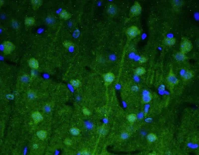Immunohistochemistry (Formalin/PFA-fixed paraffin-embedded sections) - Anti-SPTBN4 antibody [N393/76] - Chicken IgY (Chimeric) (AB325666)