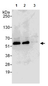 Immunoprecipitation - Anti-SPTLC1 antibody (AB176706)