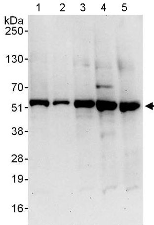 Western blot - Anti-SPTLC1 antibody (AB176706)