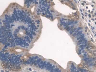 Immunohistochemistry (Formalin/PFA-fixed paraffin-embedded sections) - Anti-SPTLC1 antibody (AB232847)
