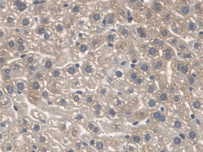 Immunohistochemistry (Formalin/PFA-fixed paraffin-embedded sections) - Anti-SPTLC1 antibody (AB232847)