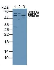 Western blot - Anti-SPTLC1 antibody (AB232847)