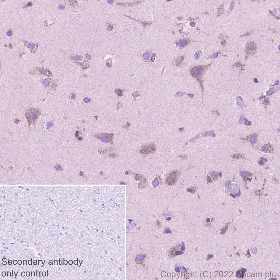 Immunohistochemistry (Formalin/PFA-fixed paraffin-embedded sections) - Anti-SPTLC1 antibody [EPR26226-136] (ab307552), expandable thumbnail