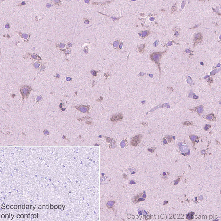 Immunohistochemistry (Formalin/PFA-fixed paraffin-embedded sections) - Anti-SPTLC1 antibody [EPR26226-136] (AB307552)