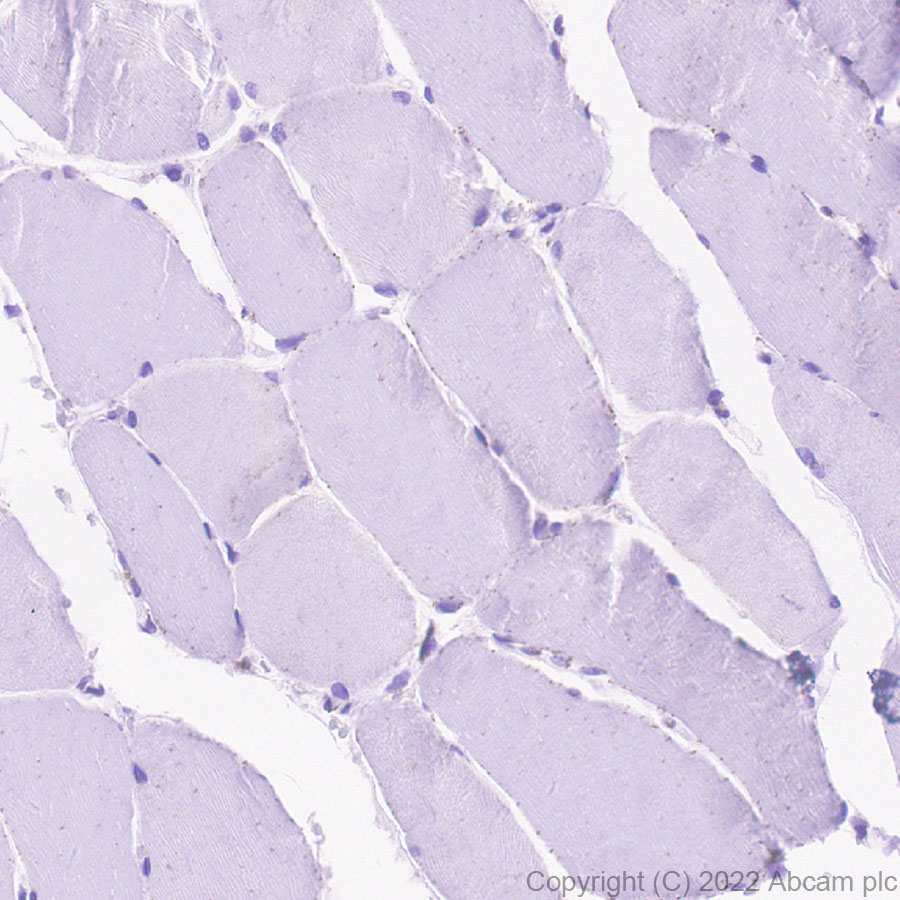 Immunohistochemistry (Formalin/PFA-fixed paraffin-embedded sections) - Anti-SPTLC1 antibody [EPR26226-136] (AB307552), expandable thumbnail