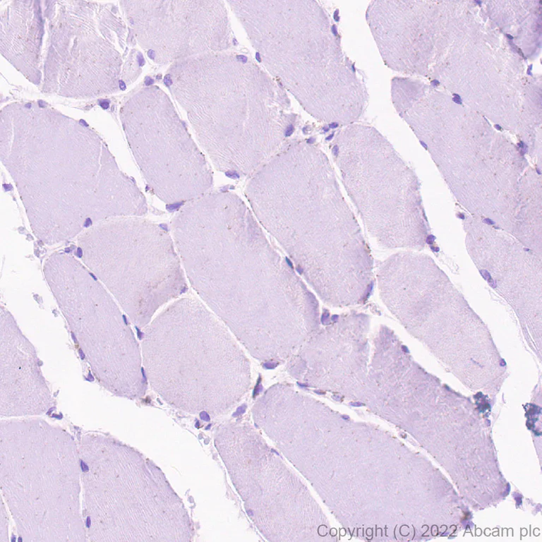 Immunohistochemistry (Formalin/PFA-fixed paraffin-embedded sections) - Anti-SPTLC1 antibody [EPR26226-136] (AB307552)