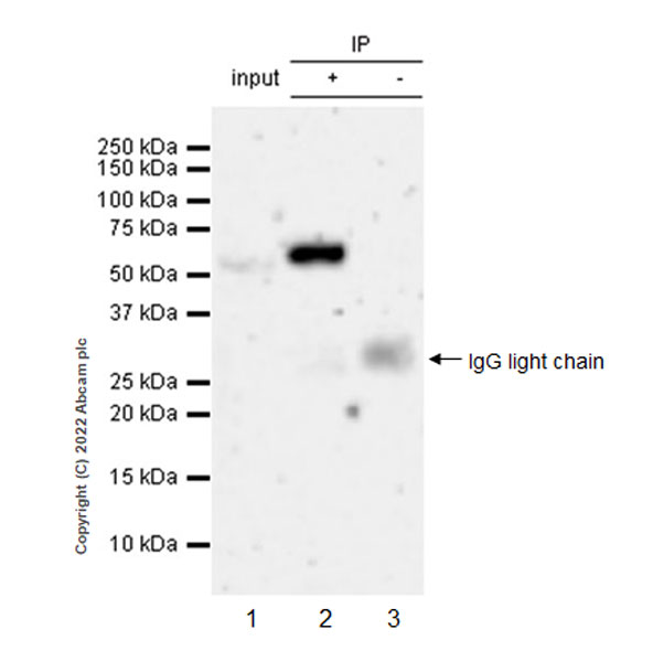 Immunoprecipitation - Anti-SPTLC1 antibody [EPR26226-136] (AB307552), expandable thumbnail