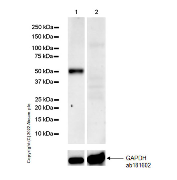 Western blot - Anti-SPTLC1 antibody [EPR26226-136] (AB307552), expandable thumbnail