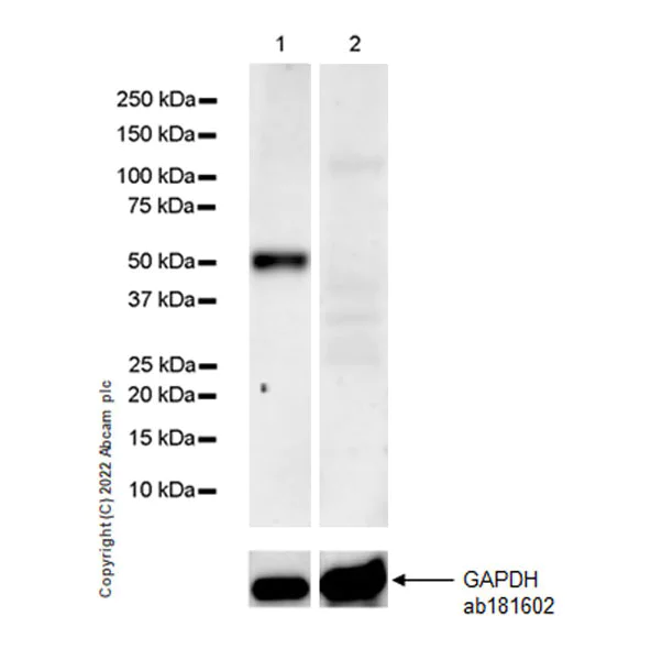 Western blot - Anti-SPTLC1 antibody [EPR26226-136] (AB307552)