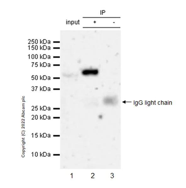 Immunoprecipitation - Anti-SPTLC1 antibody [EPR26226-136] - BSA and Azide free (AB307553)