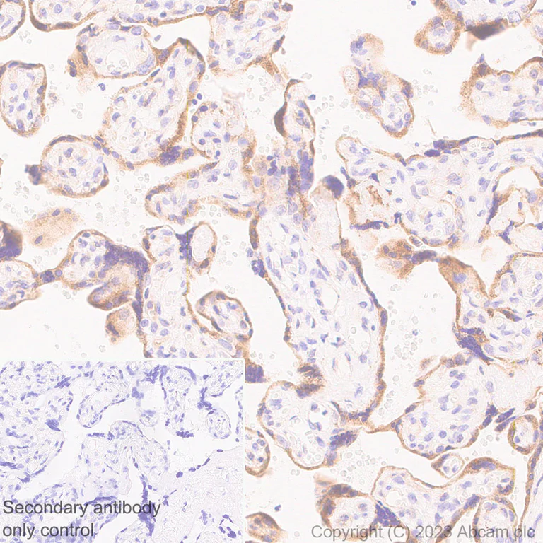 Immunohistochemistry (Formalin/PFA-fixed paraffin-embedded sections) - Anti-SPTLC1 antibody [EPR26226-221] (AB315158)
