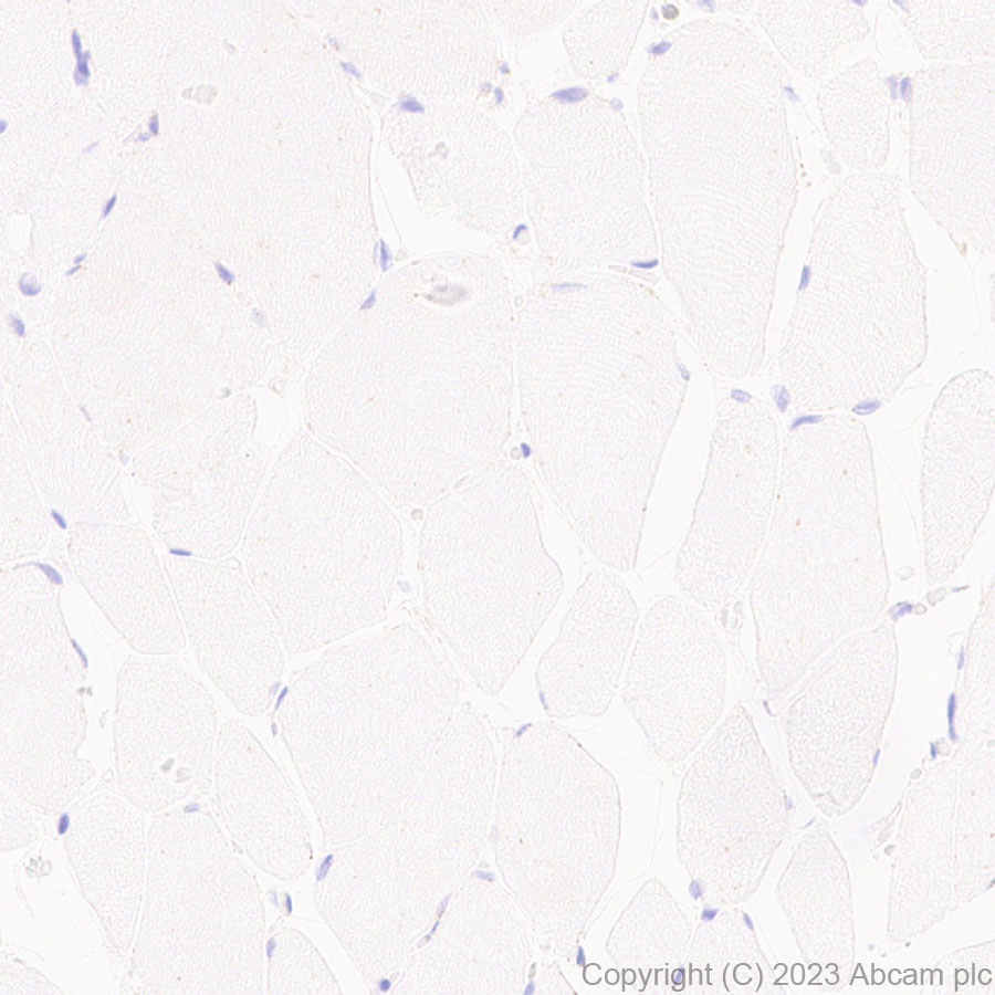 Immunohistochemistry (Formalin/PFA-fixed paraffin-embedded sections) - Anti-SPTLC1 antibody [EPR26226-221] (AB315158)