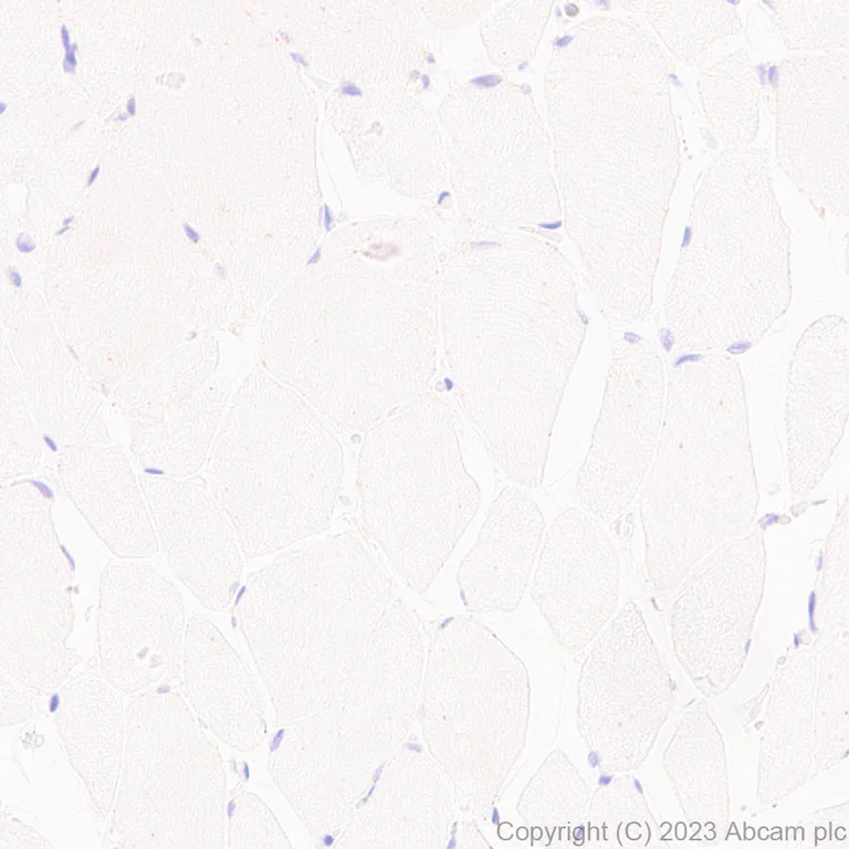 Immunohistochemistry (Formalin/PFA-fixed paraffin-embedded sections) - Anti-SPTLC1 antibody [EPR26226-221] (AB315158)