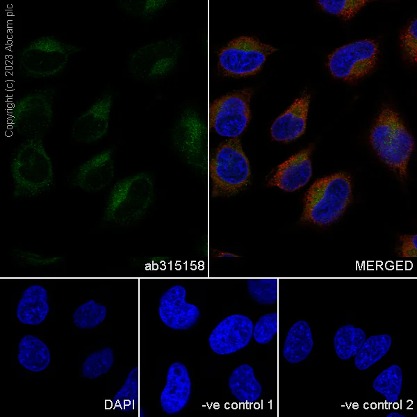 Immunocytochemistry/ Immunofluorescence - Anti-SPTLC1 antibody [EPR26226-221] - BSA and Azide free (AB315159)