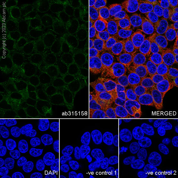 Immunocytochemistry/ Immunofluorescence - Anti-SPTLC1 antibody [EPR26226-221] - BSA and Azide free (AB315159)