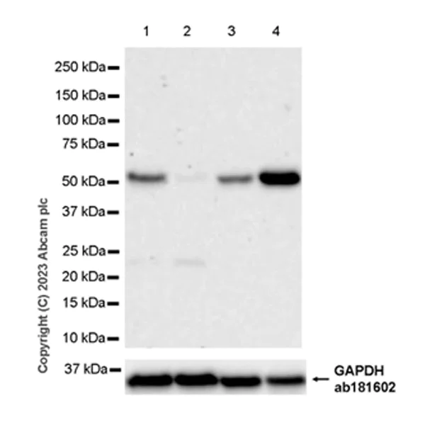 Western blot - Anti-SPTLC1 antibody [EPR26226-221] - BSA and Azide free (AB315159)