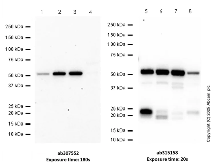 Western blot - Anti-SPTLC1 antibody [EPR26226-221] - BSA and Azide free (AB315159)