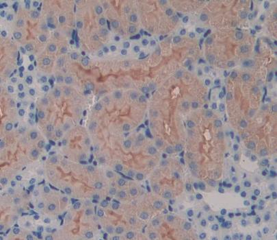 Immunohistochemistry (Formalin/PFA-fixed paraffin-embedded sections) - Anti-SPTLC3 antibody (AB232829)